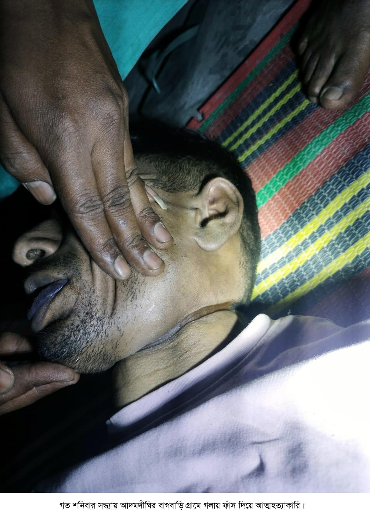 আদমদীঘিতে গলায় ফাঁস দিয়ে একজনের আত্মহত্যা